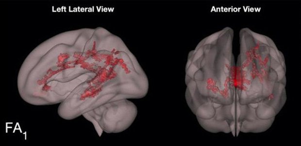 Photos taken inside the brain of a child who reads books and a child who looks at the phone, computer… startle parents