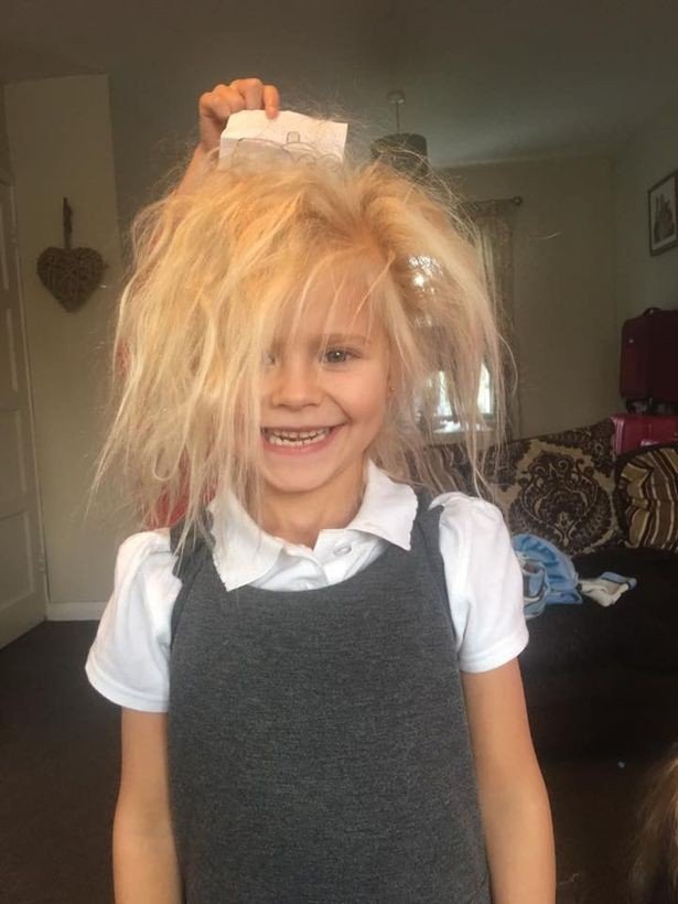 The 7-year-old girl has `tangled hair` syndrome just like the killer doll in a horror movie